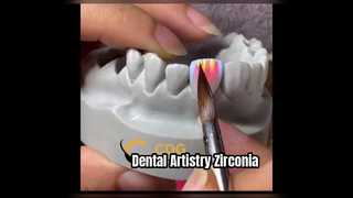 The Art of Porcelain Buildup