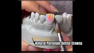 The Art of Porcelain Buildup