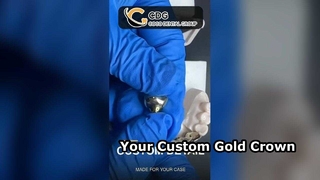 Custom Bespoke Gold Crown Handcrafted for You