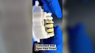 Custom full metal crown dental lab